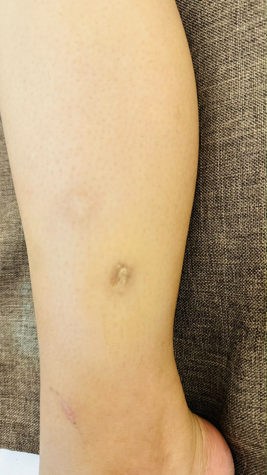 Scar Camouflage